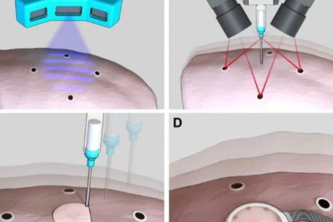 《Science》子刊：在活體器官上原位3D打印可變形水凝膠傳感器！