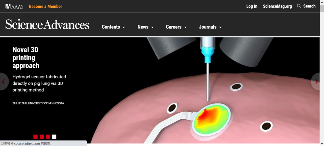 《Science》子刊：在活體器官上原位3D打印可變形水凝膠傳感器！