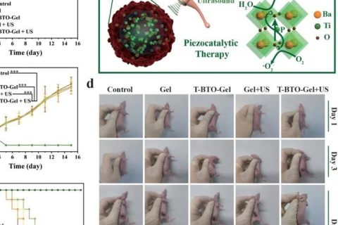 施劍林院士、陳雨研究員《先進材料》：超聲引發(fā)鈦酸鋇壓電性用于無創(chuàng)壓電催化腫瘤療法