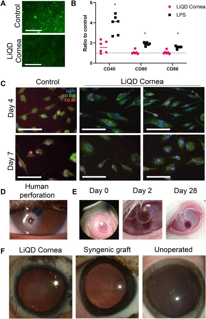 Science子刊重磅：無需角膜移植手術(shù)！新型可注射水凝膠膠原蛋白基質(zhì)仿生角膜和“膠填充劑”