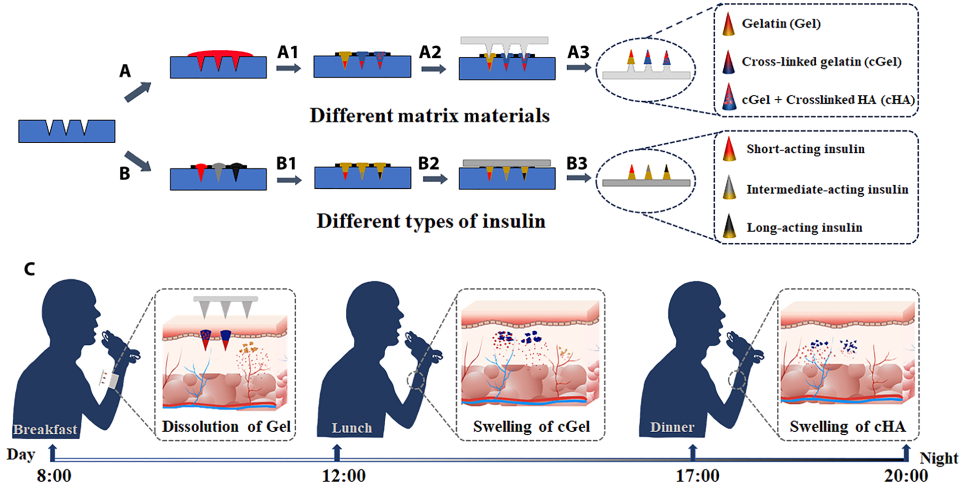 北京化工大學郭新東《Sci.Adv.》：無痛貼片！貼一片，血糖穩(wěn)一天