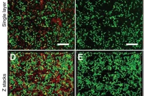 新加坡國立大學(xué)《AFM?》：肉眼可見！共軛低聚電解質(zhì)助力革蘭氏細(xì)菌的區(qū)分