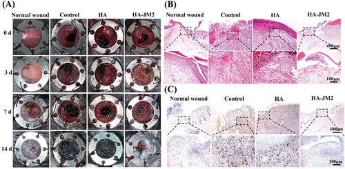 不懼腫瘤術(shù)后復(fù)發(fā)！上交大李海燕《AFM》：用于內(nèi)部組織修復(fù)和抗術(shù)后粘連的Janus水凝膠濕粘合劑，