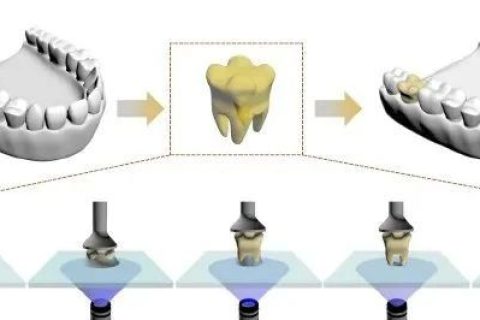強(qiáng)大，一滴樹(shù)脂就能打印一顆牙齒！中科院化學(xué)所實(shí)現(xiàn)單液滴3D打印技術(shù)