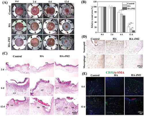 不懼腫瘤術(shù)后復(fù)發(fā)！上交大李海燕《AFM》：用于內(nèi)部組織修復(fù)和抗術(shù)后粘連的Janus水凝膠濕粘合劑，