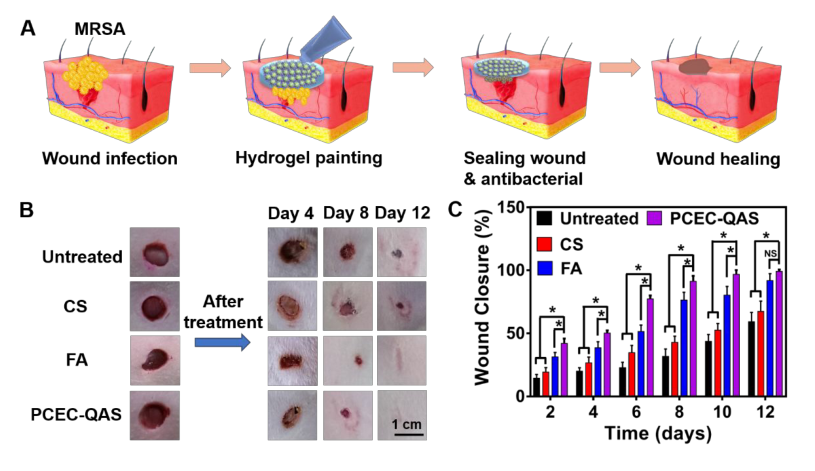 醫(yī)科院王偉偉等《ACS Nano》：直達(dá)真皮層，100%修復(fù)：合成高分子抗菌水凝膠用于耐甲氧西林金黃色葡萄球菌感染傷口愈合