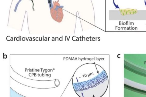 MIT趙選賀教授：超薄、耐用的水凝膠涂層：可同時減輕血栓和感染性并發(fā)癥